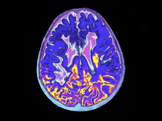 ارزیابی قابلیت آنالیز عملکردی fMRI 